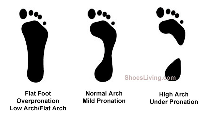 Shoes Feet Shoes  Make Own flat and for  for Your Design, and overpronation feet shoes  Flat Customize,